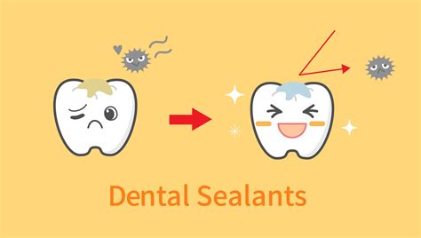 Dental Sealants