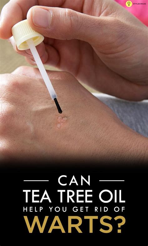 Image result for tea tree oil warts