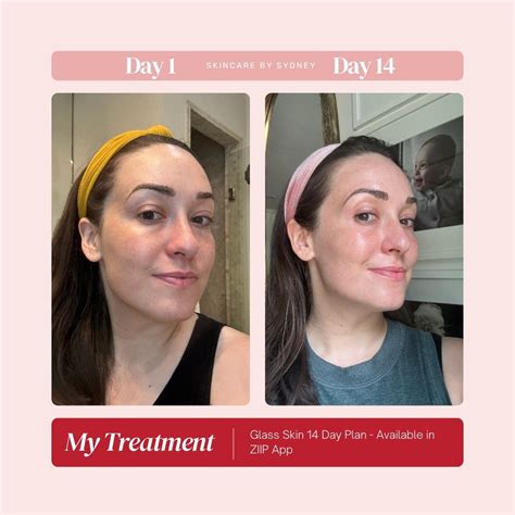 ZIIP HALO - Is it the World's Most Powerful Facial Toning Device? – Skincare by Sydney