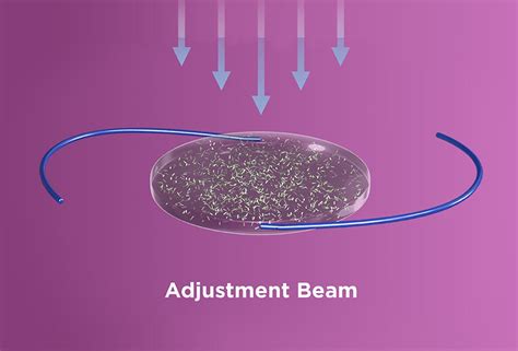 Image result for Light Adjustable Lens Problems