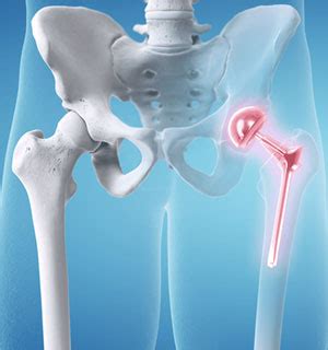 Dr. Aman Singh Chandel | Orthopedic Surgeon