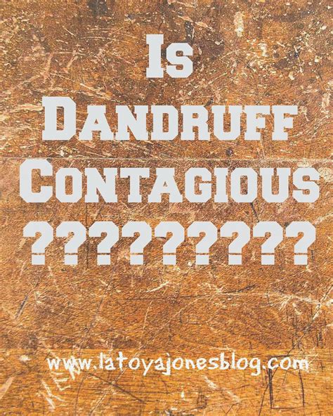 Is Dandruff Contagious? | LaToya Jones