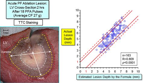 Evaluation of Ablation Parameters to Predict Irreversible Lesion Size ...