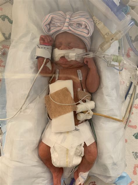 Celebrating NICU families - Mary Bridge Children's