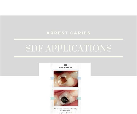 Kids Dentist® Little teeth first - Home