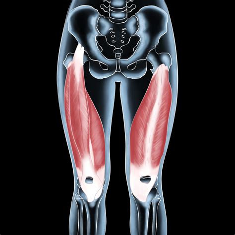 Quad Muscles Pain