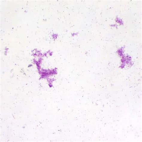 Cole-Parmer® Prepared Microscope Slides, Bacteria and Fungi from Cole ...