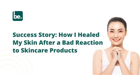 Success Story: How I Healed My Skin After a Bad Reaction to Skincare P ...