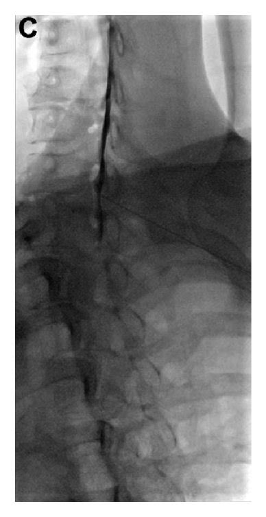 Image result for Contralateral Oblique View