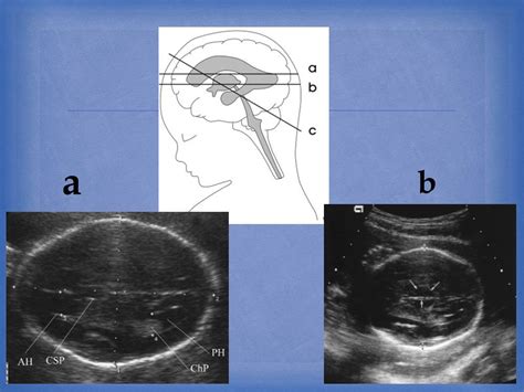 Image result for Biometry Ob