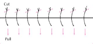 Removing Sutures Step by Step 的图像结果