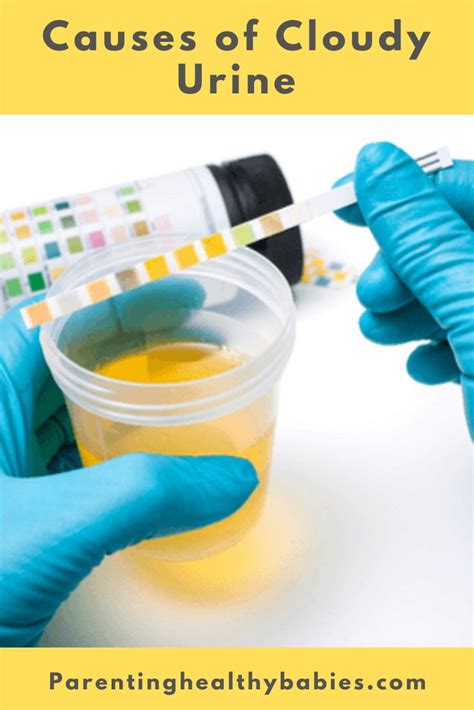 Is Cloudy Urine A sign of Pregnancy? | Cloudy urine, Urinal, Pregnancy ...