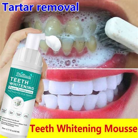 Teeth Whitening Products Online in India at Best Prices | Flipkart.com
