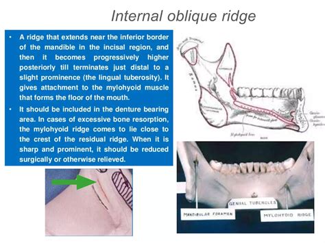 Maxillary and mandibular anatomical land marks | PPTX