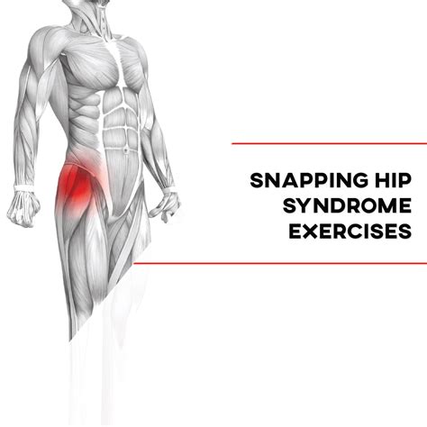Exercises for Snapping Hip Syndrome - [P]rehab