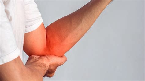 Golfer's Elbow (Medial Epicondylitis) - ANF