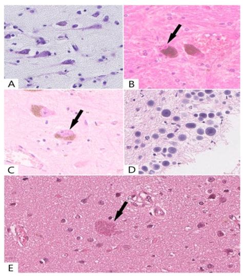 Brain Neurons during Physiological Aging: Morphological Features ...