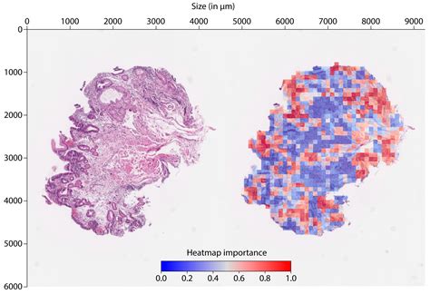 Deep Learning Histology for Prediction of Lymph Node Metastases and ...