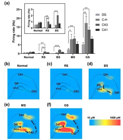 In Vivo Microelectrode Arrays for Detecting Multi-Region Epileptic ...