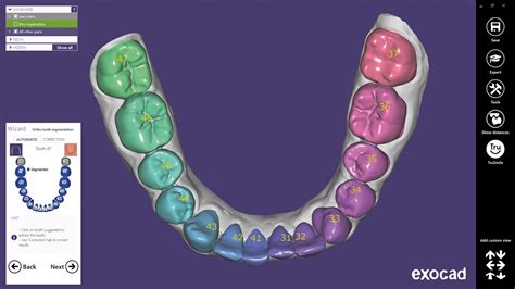 Exocad webview