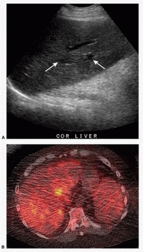Image result for Ultrasound Lab