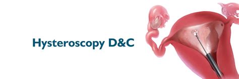 Hysteroscopy: Procedure, Side Effects and Recovery