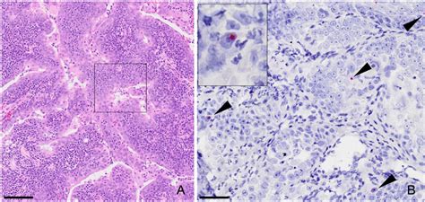 Oropharyngeal Shedding of Gammaherpesvirus DNA by Cats, and Natural ...