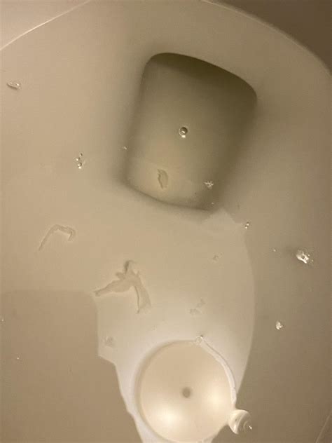 What is this white tissue? In urine with cramping over past two months (been passing small ...