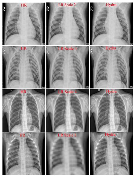 Accelerating Super-Resolution and Visual Task Analysis in Medical Images