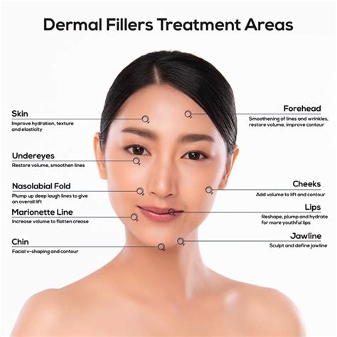 Dermal Fillers Forehead 的图像结果