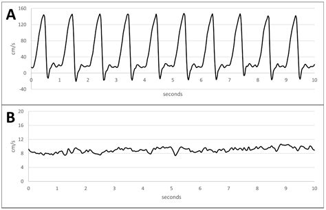 An Arteriovenous Bioreactor Perfusion System for Physiological In Vitro ...