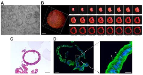 Two Different Therapeutic Approaches for SARS-CoV-2 in hiPSCs-Derived ...