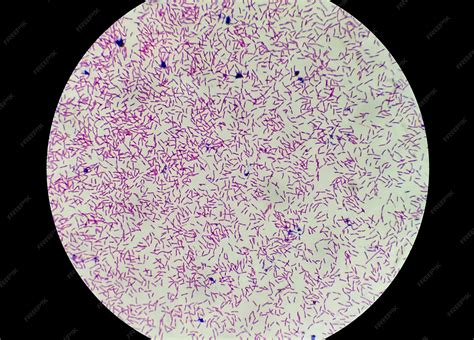 Gram Stain E Coli