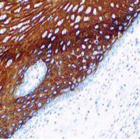 Cytokeratin 13-EP69 | PathnSitu Biotechnologies