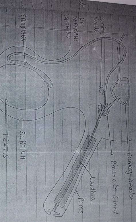 Draw a diagram of human excretory system and label the following:a ...