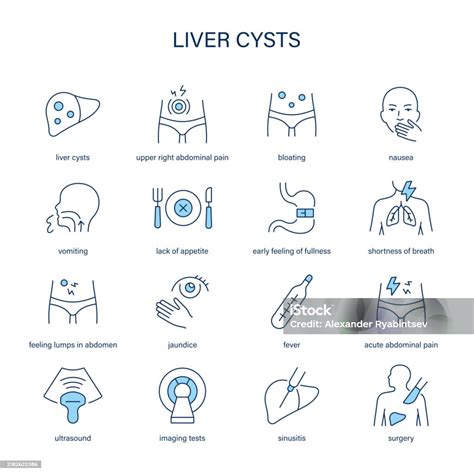Liver Cysts Symptoms Diagnostic And Treatment Vector Icon Set Medical Icons Stock Illustration ...