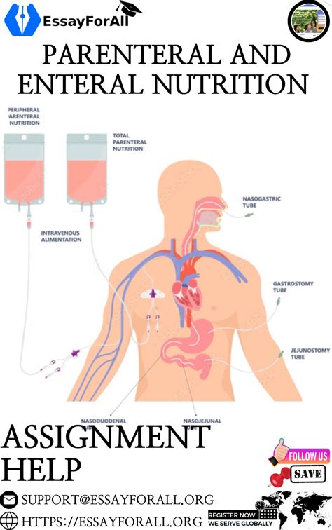 Enteral Vs Parenteral Nutrition