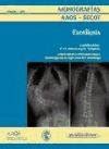 Buy Escoliosis Book Online at Low Prices in India | Escoliosis Reviews ...