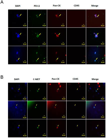 An Immune–Magnetophoretic Device for the Selective and Precise ...