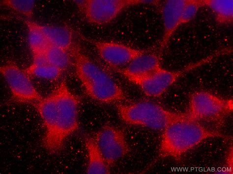APOL1 antibody (11486-2-AP) | Proteintech