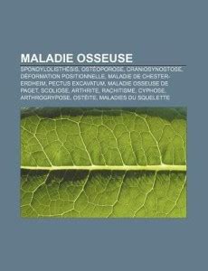 Maladie Osseuse: Spondylolisth Sis, Ost Oporose, Craniosynostose, D ...