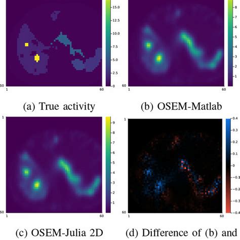 Image result for Iterative Reconstruction Osem