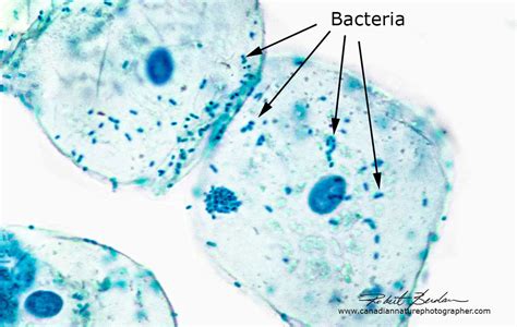 Cheeks Cells Under a Compound Microscope 的图像结果