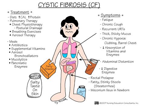 Stools In Cystic Fibrosis at Terry Prater blog