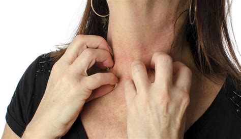 Morgellons: The skin-crawling disease that is all in the head | The ...