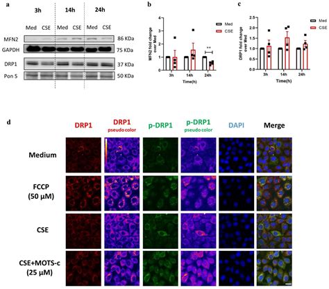 Cigarette Smoke Extract Disturbs Mitochondria-Regulated Airway ...