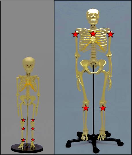Image result for Intraosseous Access Procedure