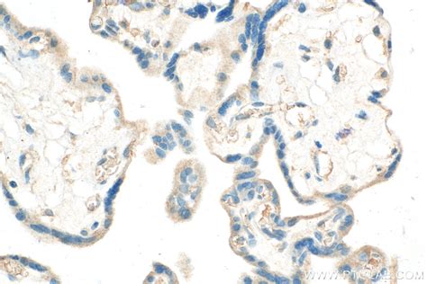 CSF2RA/CD116 antibody (18307-1-AP) | Proteintech
