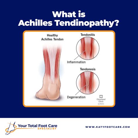 What is Achilles Tendinopathy? | Your Total Foot Care Specialist