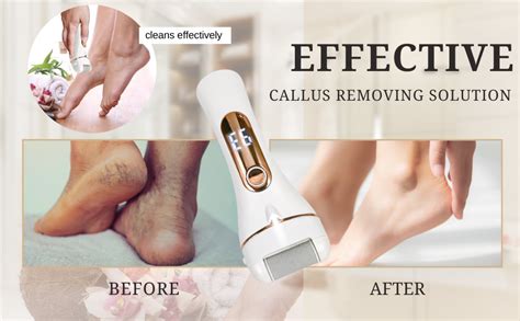 Ladiosa® Foot Scrubber for Dead Skin, Pedicure Kit for Women for Foot ...